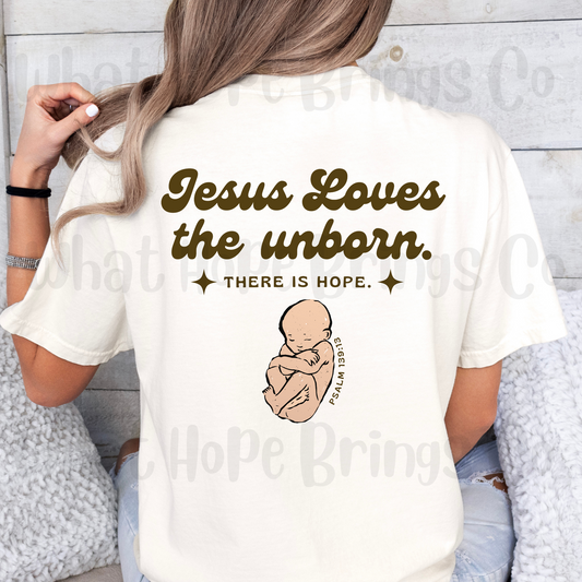 Jesus Loves the Unborn